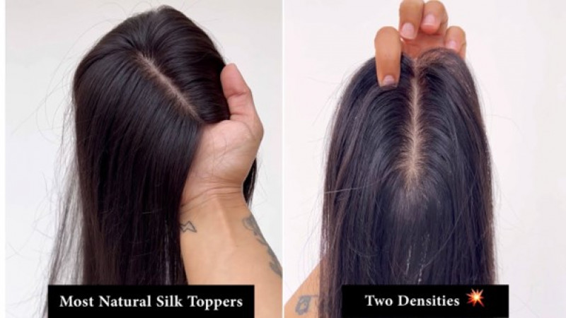 Enhance Your Hairline: Discover the Magic of Hair Toppers: 