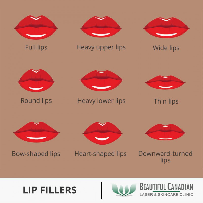 Lip fillers and lip injections - how they work: 
